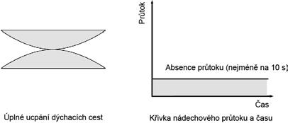 Apnoe Zdokonalený algoritmus AutoSet rozpozná obstrukční i centrální apnoe. Pokud se vyskytne apnoe, přístroj příslušně reaguje.