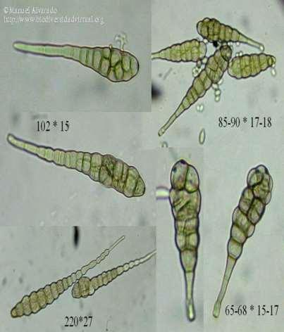 (http://www.biodiversidadvirtual.org/hongos/alternaria-solani- (Ellis-y-G.-Martin)-L.R.-Jones-y-Grout-1896.-img57215.html) HNĚDÁ A TERČOVITÁ SKVRNITOST BRAMBORU (http://www.