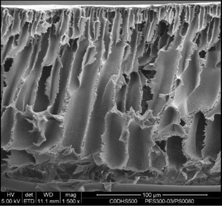 Obr. 3: Ukázka typické prstové struktury (finger-like) filtrační membrány od Synder Filtration (http://synderfiltration.