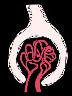 GFR regulace Afferent arteriole Result Efferent arteriole Dilatation Constriction Prostaglandins Angiotensin II Kinins Sympathetic stimulation GFR Dopamine Atrial natriuretic peptide Atrial