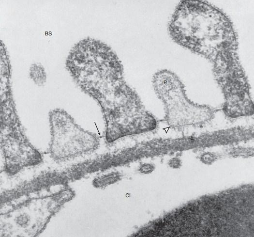 Glomerulární membrána Glomerulární membrána Endotel (fenestrace) Bazální membrána Podocyty Cesta filtrátu je zcela extracelulární Póry cca 2,9 nm do 15 kda bez omezení nad 65 kda nepropustná Brenner