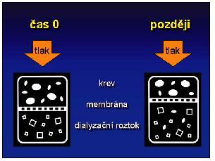3.4. Hemodialýza Hemodialýza je metoda očišťování krve, která se používá při léčbě akutního a chronického selhání ledvin.