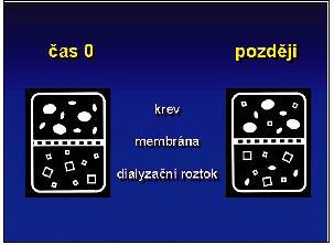 Obrázek č. 8: Schéma filtrace při hemodialýze.