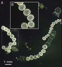 zakřivené, větvící se, palisády pleomorfní Kokobacily Pupeny Prostéky Spirily Hvězdice Mycelia 750 µm - největší