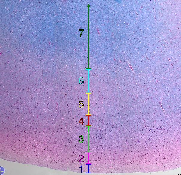 B45 cerebrum cortex LFB 1 lamina molecularis 5 lamina pyramidalis interna 2 lamina granularis