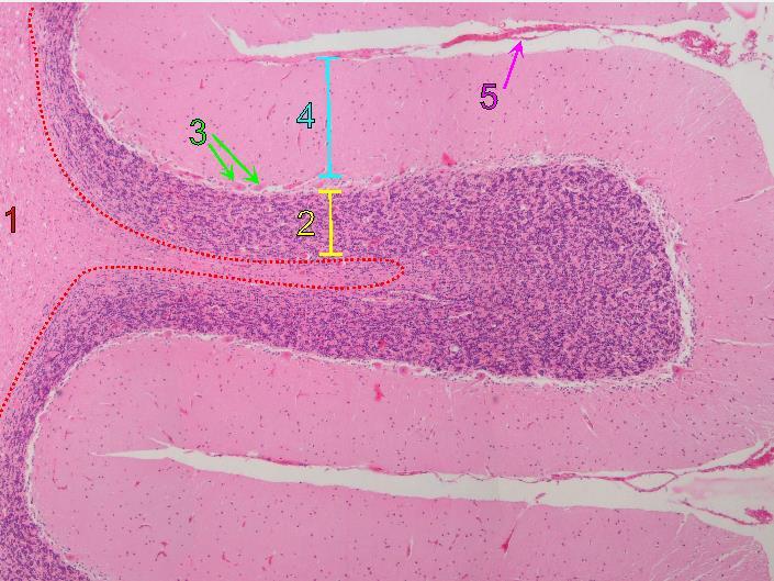 B46 cerebellum HE 1 bílá hmota 4 vrstva molekulární 2