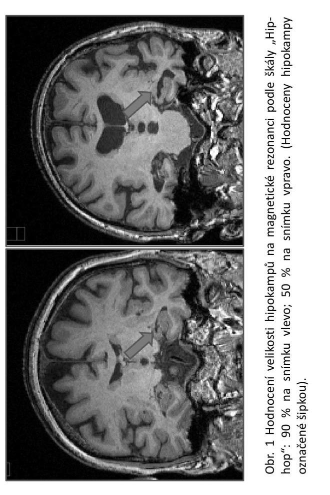 Obr. 1: