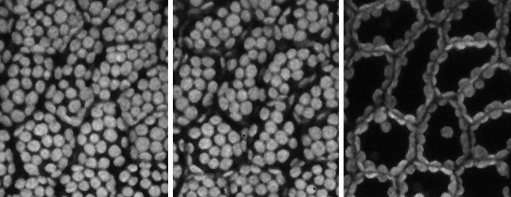 32 Fototropiny hrají roli v pohybu chloroplastů Dark Slabé