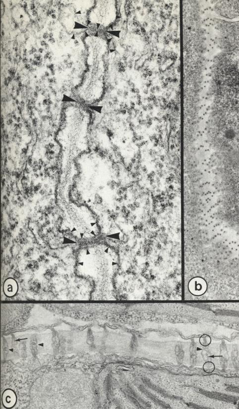 Plasmodesmy (j.č. plasmodesmus, m.r.) Symplastické spojení mezi protoplasty rostlinných buněk Plasmodesmy jsou tvořeny kanálky skrze buněčnou stěnu o průměru 40-50 nm.