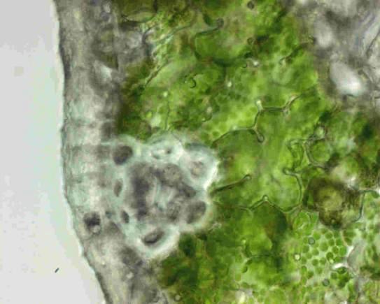 Buňky mesofylu (borovice) MT