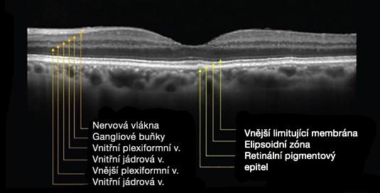 Kapitola 1 Anatomie a fyziologie oční koule 19 synapse čípků s dendrity bipolárních buněk.