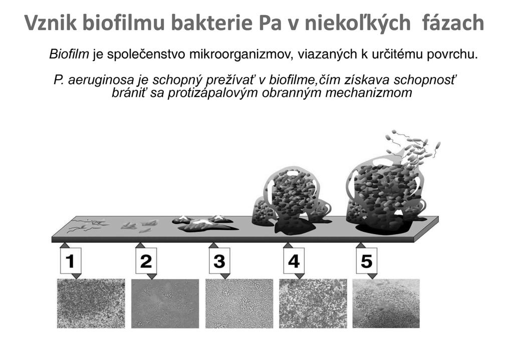 5 Niektoré nové aspekty