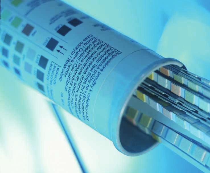 BIOCHEMICKÉ VYŠET ENÍ MO E K rychlému kvalitativnímu nebo semikvantitativnímu vyšet ení mo e se používají diagnostické proužky.
