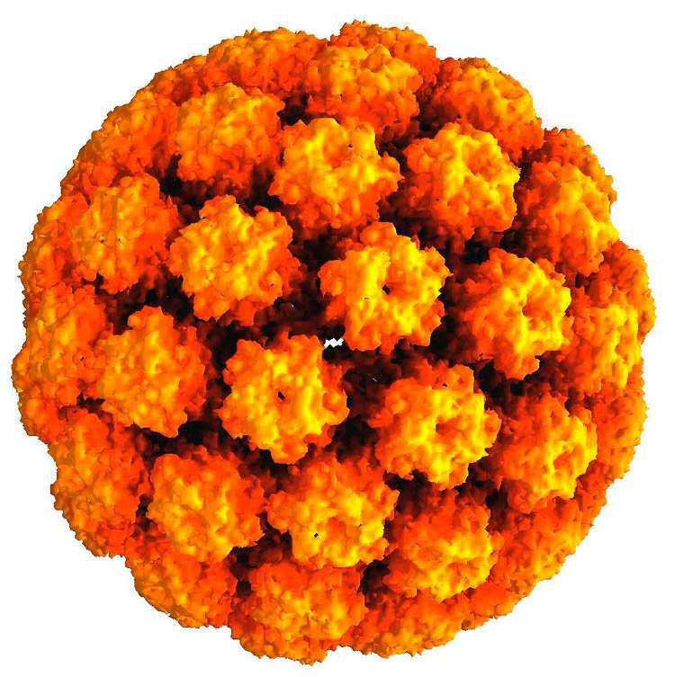 Za rizikový faktor je považována infekce papillomavirem (HPV - human papillomavirus, zejména typy 16, 18, 45 a 56) (obr. č.