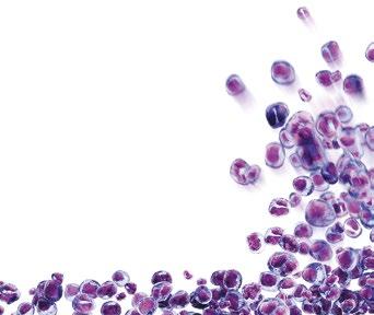 mnohočetným myelomem, kteří již prodělali nejméně jednu předchozí léčbu 3 Superiorita všech důležitých ukazatelů úspěšnosti terapie léčebné