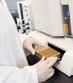 imunohematologie Post-transplantační