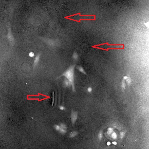 Obrázek 41: Obraz navázané fáze z druhého pozorování. Artefakty v obraze jsou způsobeny vlivem opticky konjugované roviny s rovinou vzorku obsahující nečistoty. Snímek je upraven expanzí kontrastu. 6.