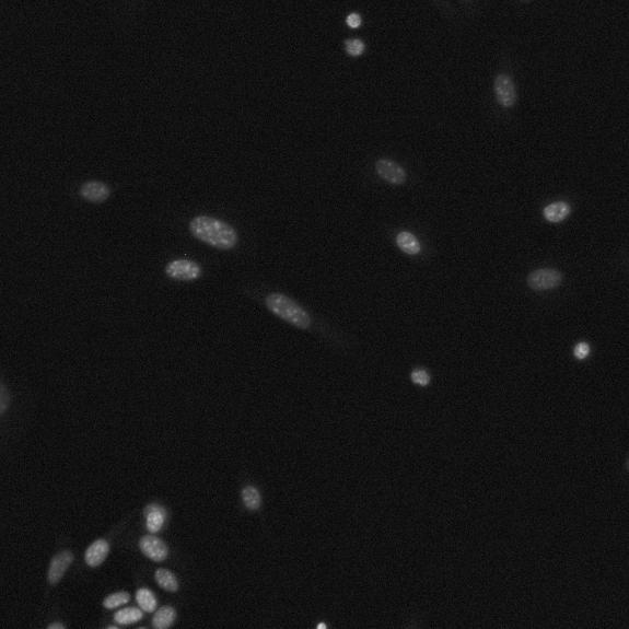 Obrázek 45: Fluorescenční snímek DAPI. Jádra září velmi intenzivně se skokovým přechodem v jasu na okrajích jádra.