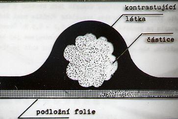 Metoda negativního barvení Obklopení