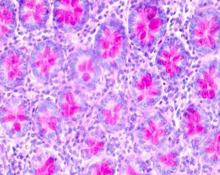 Průkaz organických látek Cukry: polysacharidy (glykogen) glykoproteiny a proteoglykany, glykolipidy = PAS reakce oxidace kys.