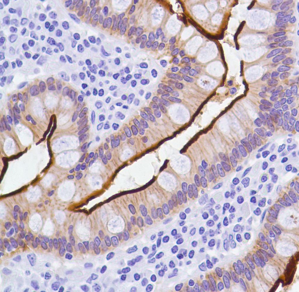 Villin cytoskeletární