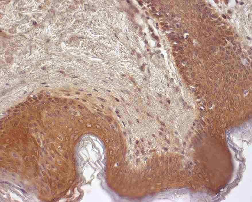 Imunohistochemie DAB +