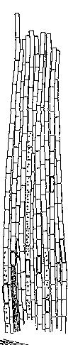 100 µm