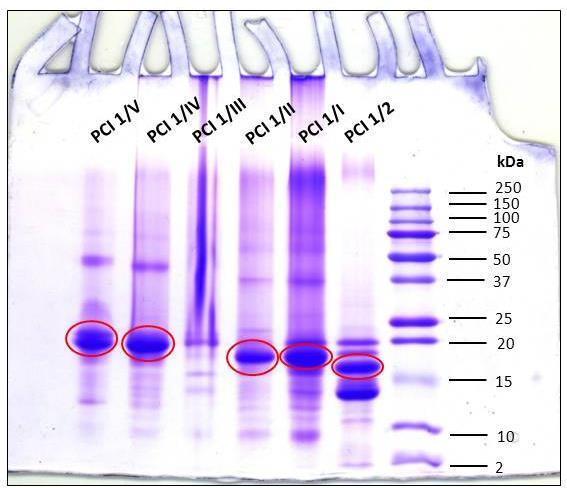 Příklad jednoduché proteomické analýzy Identifikace proteinu (z gelu nebo z roztoku) LC-MS/MS