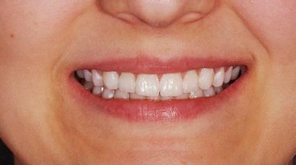 Moderný endodontický koncept Svet bez amalgámu Dr.
