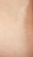 JEDNODÍLNÝ SYSTÉM SÁČEK 1D VÝPUSTNÝ STOMOCUR PROTECT ILEO MICROSKIN lepicí plocha z extra tenké elastické fólie MicroSkin (0,02 mm), která spolehlivě přilne na nerovný povrch v
