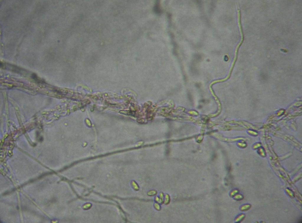 [21 z 32] Fusarium
