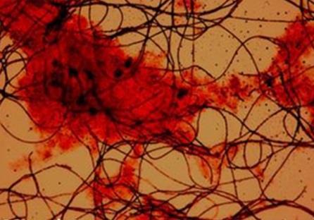 Mycobacterium, Nitrobacter, Nitrosomonas, Nocardia, Pseudomonas houby, plísně, kvasinky přítomny v menším množství