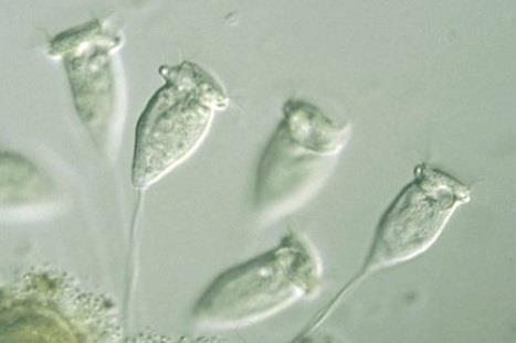 Beggiatoa, Leptomitus, Leucothrix, Microthrix parvicella, Nocardia, Sphaerotilus, Thiothrix převaha vláknitých