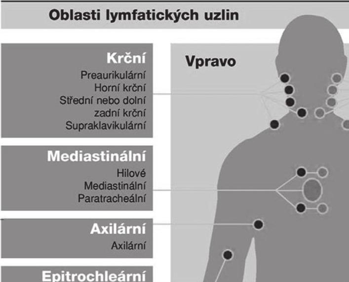Obr. 2: Jednotlivé oblasti lymfatických uzlin pro folikulární lymfomy (velká pole představují jednu