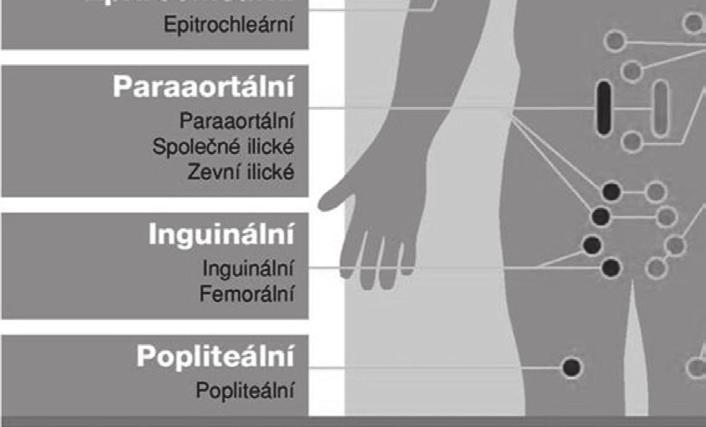 splenomegalie > 13 cm v podélné ose Difusní infi ltrace s miliárním rozsevem Fokální nodulární infi