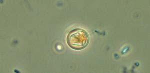 Chrysococcus Dinobryon na jaře i na podzim nejběžnější