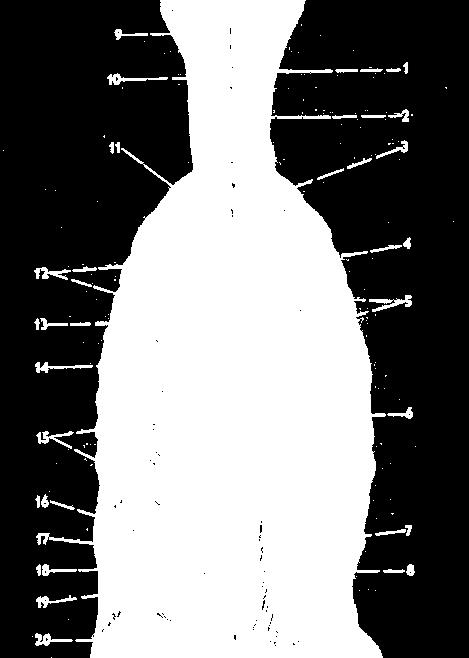Třetí vrstva m. serratus posterior superior nn. intercostales 2-5 m.
