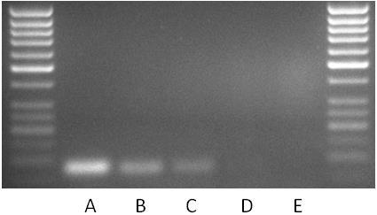 vložena do plasmidového vektoru. Funkčnost plasmidu byla ověřena konstrukcí kalibrační křivky a provedením PCR reakce v přítomnosti různých DNA (zemědělské plodiny, houby, bakterie).