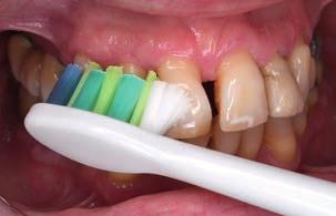 InterCare Mini Tryska AirFloss Ultra Premium Plaque Defense Premium
