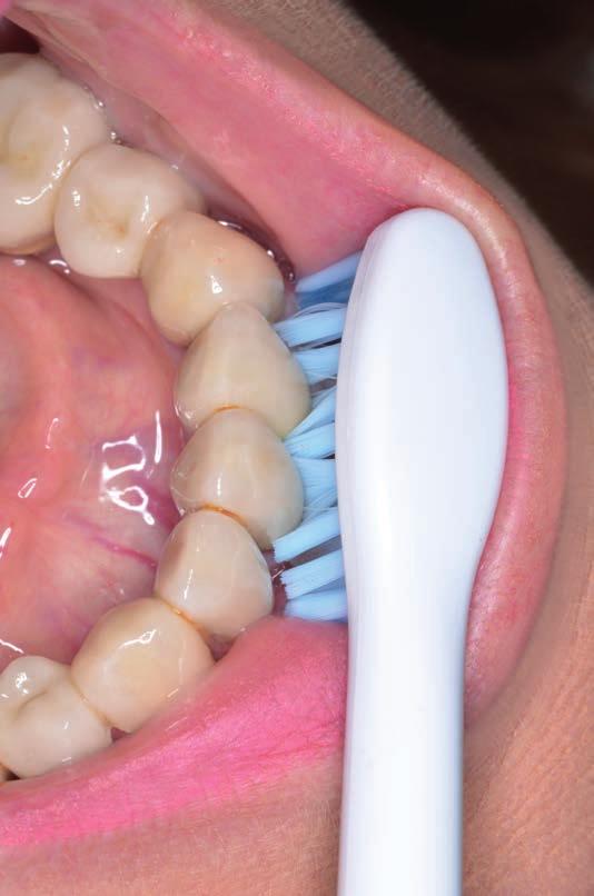 Pacient s protetickou prací Philips Oral HealthCare Pacient s