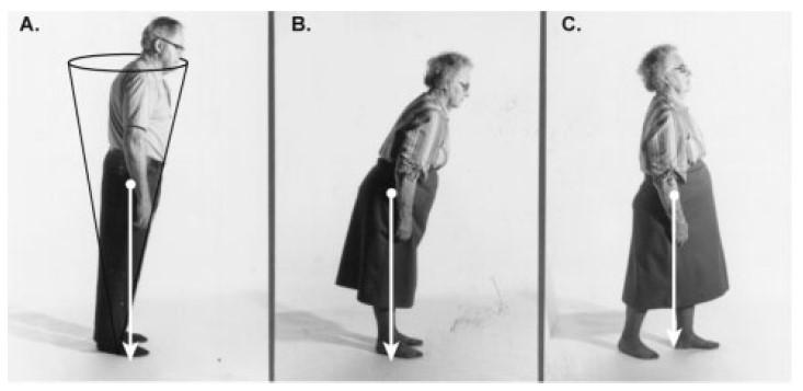 roli v udržování rovnováhy ve frontální rovině hrají svaly působící inverzi a everzi (Winter et al., 2009).