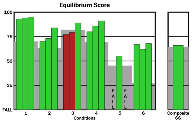 Graf č. 1 Vstupní Equilibrium Score a Composite Equilibrium Score grafické znázornění naměřených dat (číselné hodnoty viz tabulka č. 1).