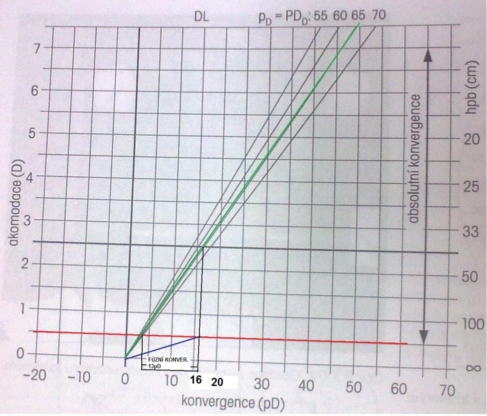 Konvergence při presbyopické korekci Příklad: Hpb = 40 cm PD = 65 mm ADD = 2D Ak = 0,5D