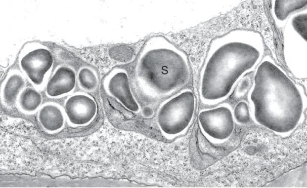 Amyloplasty 7 Bezpigmentové plastidy, syntetizují a shromažďují škrob; velké jako chloroplasty Zásobní pletiva kořenů, stonků a endosperm obilovin Škrobová zrna (kořenová