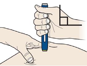 A Krok 3: Podání injekce Udržujte napnutí nebo stisk. Předplněné pero se sejmutým oranžovým krytem PŘILOŽTE k pokožce pod úhlem 90 stupňů. 90º NEDOTÝKEJTE se zatím šedého dávkovacího tlačítka.