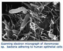 2005) Nová čeleď Aeromonadaceae mnoho společných biochemických znaků (Abbott 2003)