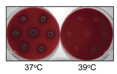 okolo 39 C, zatímco ideální teplota pro produkci faktorů virulence (Prugnola et al., 1995). B. pertussis je 37 C V rámci zmíněné studie byl proveden test kultivace bakterie v teplotách 37 C a 39 C.