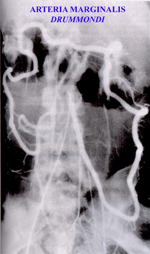 Tlusté střevo a. mesenterica sup. a. ileocolica a. ceacalis ant. + post., a. appendicularis a. colica dx. (colon ascendens) a.