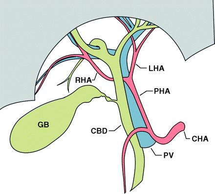 Anatomické poznámky VP vzniká soutokem VMS + VL na zadní straně hlavy