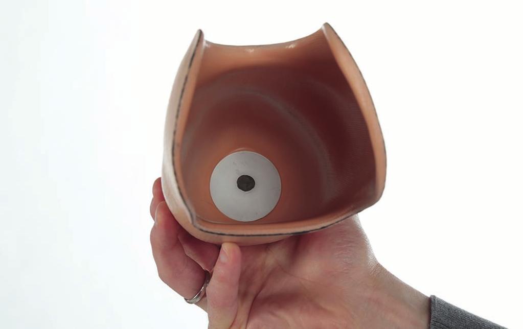 Vyšroubujte laminační pomůcku ventilu. Sejměte pahýlové lůžko ze sádrového modelu.